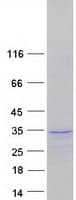 Human SOX21 Protein (Recombinant Myc-DDK (Flag))