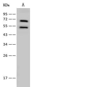 KARS Antibody (Preservative Free)