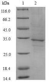Human FLT3LG / Flt3 Ligand Protein (Recombinant 6His-SUMO, N-terminus)