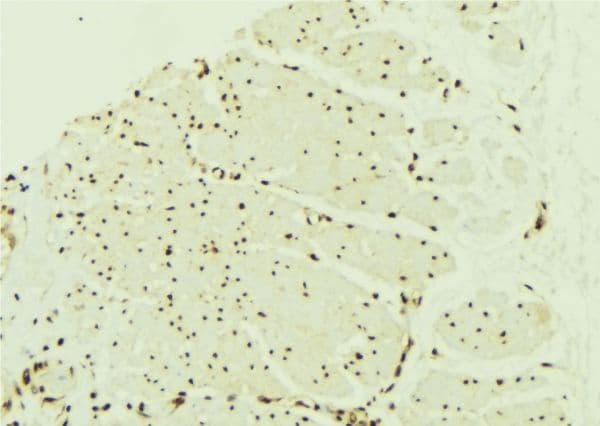 PPARA / PPAR Alpha Antibody