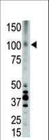 APOER2 / LRP8 Antibody (aa934-963)