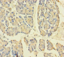 APPL1 / APPL Antibody