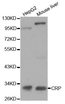 CRP / C-Reactive Protein Antibody