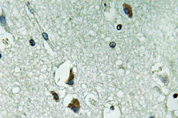 PH / PAH Antibody (Arg400)