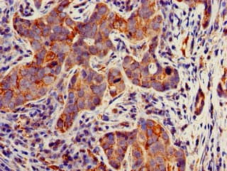 Polyclonal Rabbit anti-Human TECPR2 Antibody (IHC, IF)