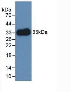 LAMC1 / Laminin Gamma 1 Antibody (aa521-772, PE)