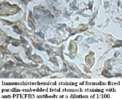 PFK2 / PFKFB3 Antibody (aa55-307)