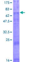 Human SLC46A2 Protein (Recombinant GST)