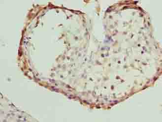 Polyclonal Rabbit anti-Human FSIP1 Antibody (IHC)