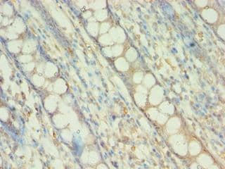 Polyclonal Rabbit anti-Human BAG5 Antibody (aa198-447, IHC, WB)