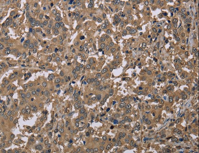 Polyclonal Rabbit anti-Human CAB39 / MO25 Antibody (IHC, WB)