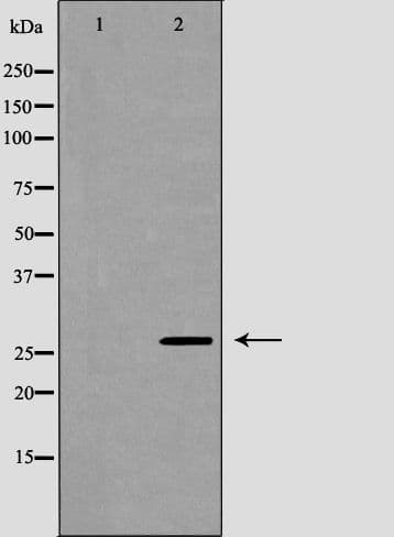VAPB Antibody