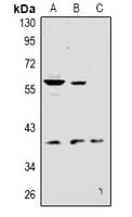 Polyclonal Rabbit anti-Human KCNK12 Antibody (WB)