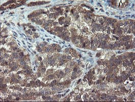 CRYZL1 Antibody (clone OTI1H11)