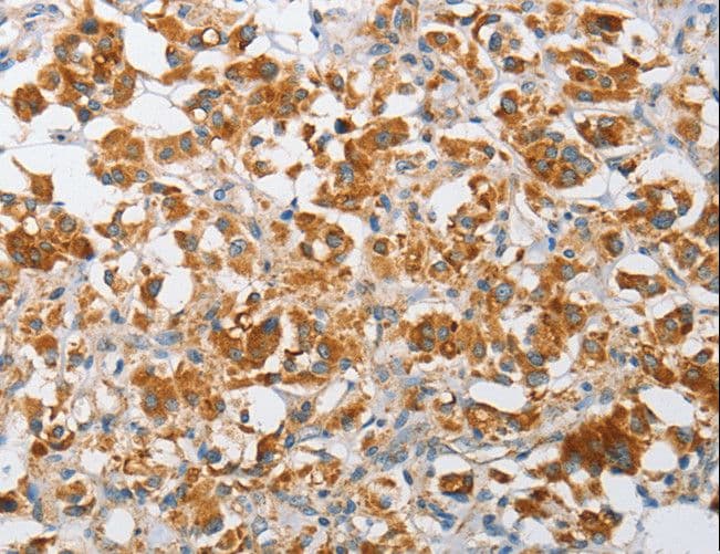 Polyclonal Rabbit anti-Human ARHGEF9 / Collybistin Antibody (IHC, WB)