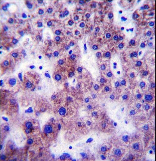 UGT1A / UGT1A1 Antibody (aa65-90)