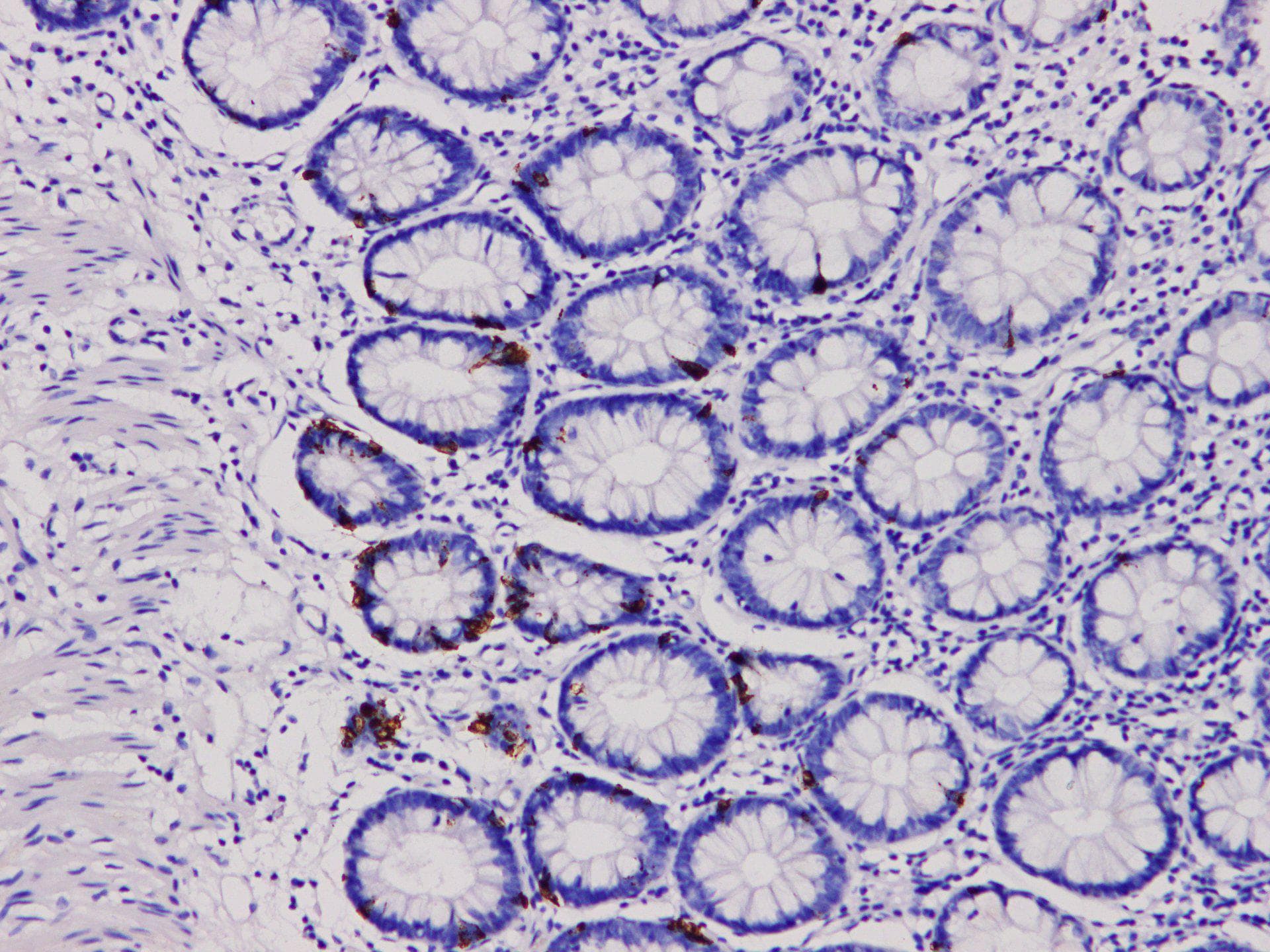 CHGA / Chromogranin A Antibody
