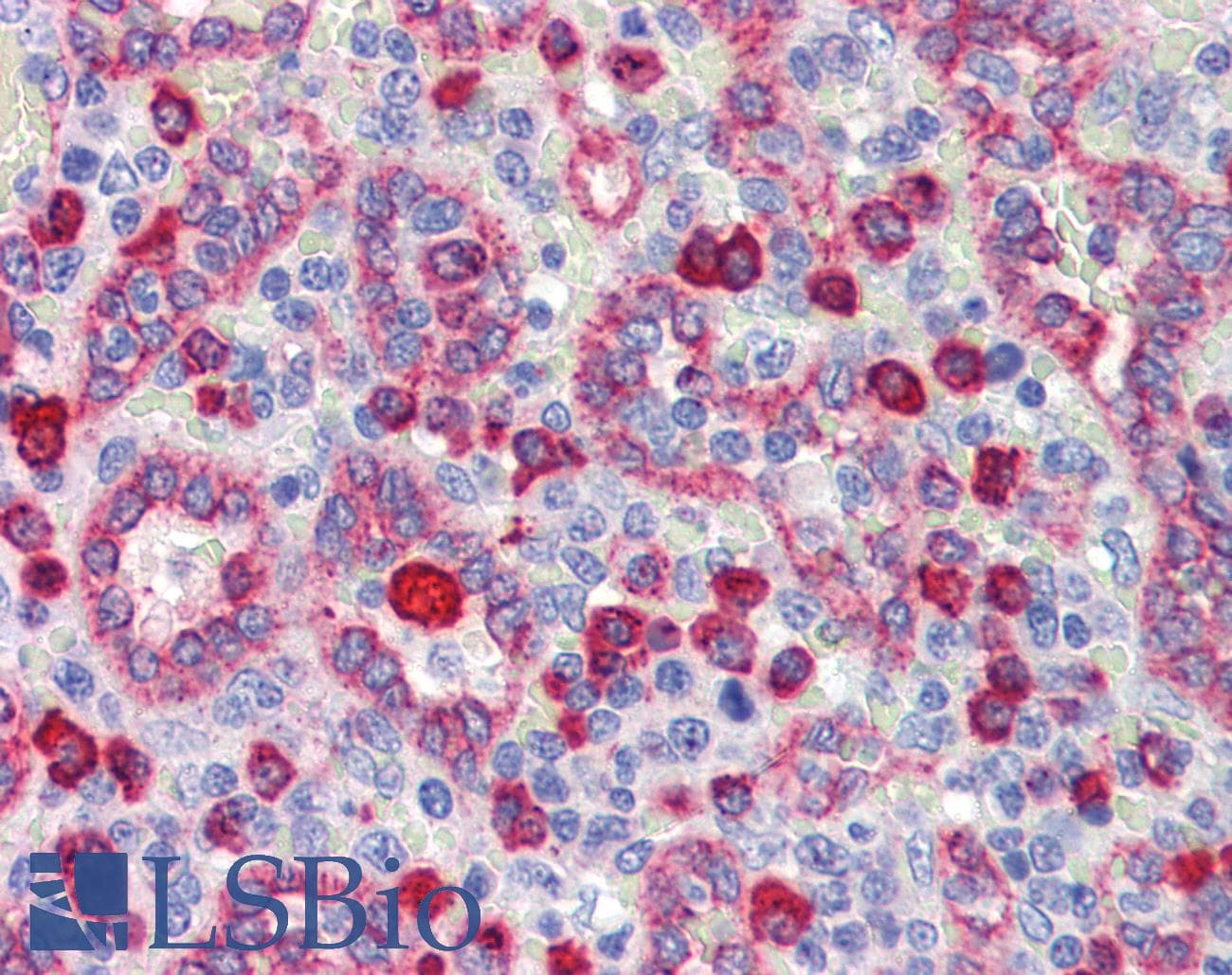 Polyclonal Rabbit anti-Human NR2C1 Antibody (N-Terminus, IHC, WB)