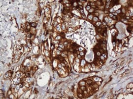 PAI-RBP1 / SERBP1 Antibody (clone OTI5G2)