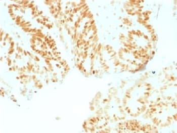 RB1 / Retinoblastoma / RB Antibody (clone RB1/1754)