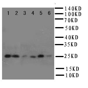 HSPB2 / HSP27 Antibody (aa102-118)