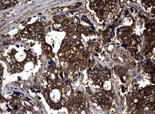 Monoclonal Mouse anti-Human NME1 / NM23 Antibody (clone UMAB94, Carrier-free, IHC, IF, WB)