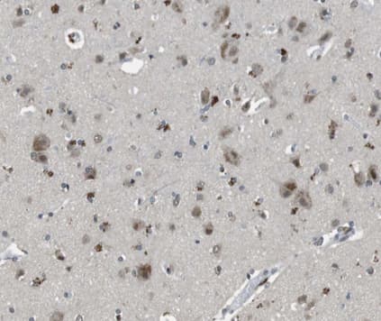 MtTFA / TFAM Antibody
