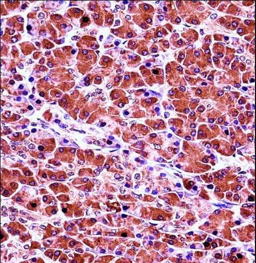 CELA3B / ELA3B Antibody (aa70-98)
