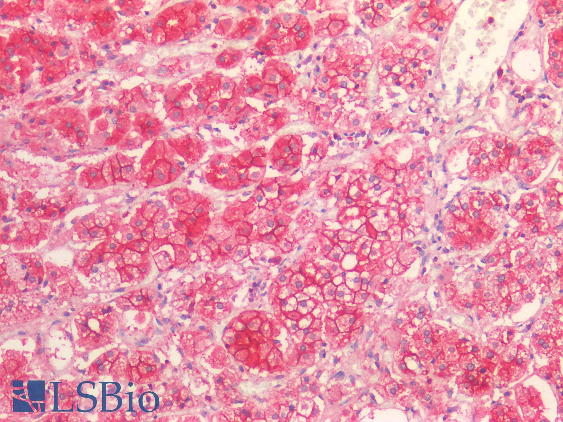 IHC-plus™ Polyclonal Goat anti-Human SCARB1 / SR-BI Antibody (aa238-250, IHC, WB)
