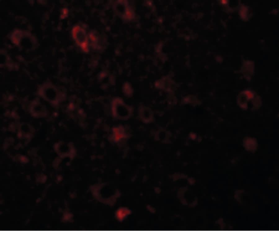 IHC-plus™ SOLO / SESTD1 Antibody