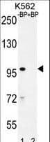 IQCA Antibody (aa794-822)