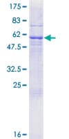 Human RAB40C Protein (Recombinant GST)