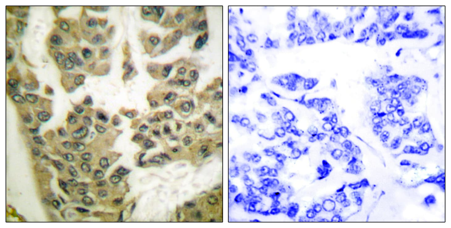 ARHGAP35 / GRLF1 Antibody (phospho-Tyr1105)