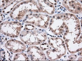 ERCC1 Antibody (clone OTI1C6)