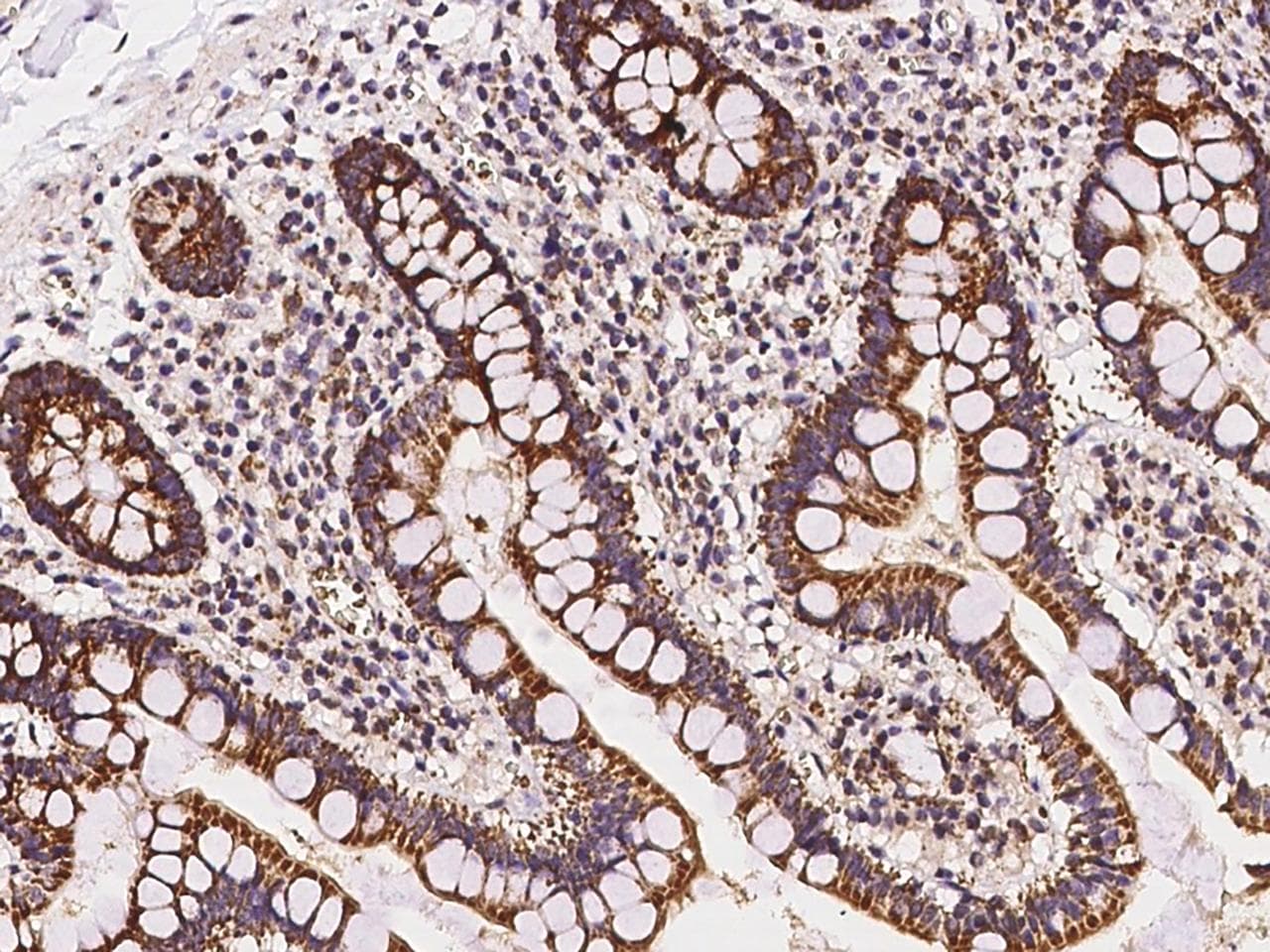 MRPL20 Antibody