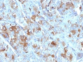 CHGA / Chromogranin A Antibody (clone CHGA/777, Ready-to-Use)