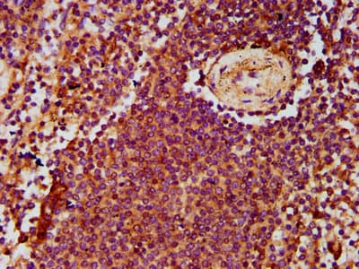 ADGRE2 / EMR2 Antibody