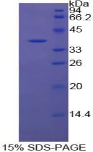 Bovine APOH / Apolipoprotein H (Recombinant His)