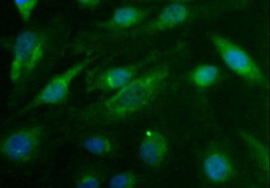 CDX1 Antibody (aa30-150, DY488)