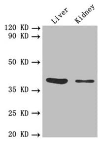 FCGRT / FCRN Antibody