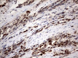 MKI67 / Ki67 Antibody (aa1160-1493, clone OTI16E9)