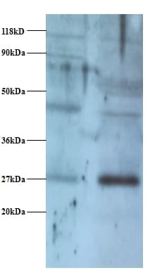 NDUFV2 Antibody