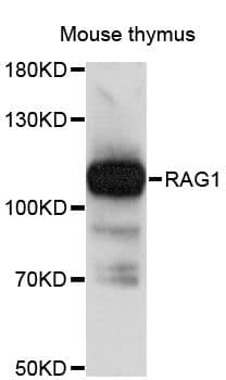 Polyclonal Rabbit anti-Human RNF74 / RAG1 Antibody (WB)