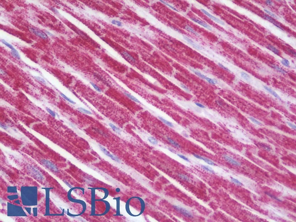 IHC-plus™ SH3BGR Antibody (aa81-130)