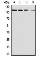 SMEK1 Antibody