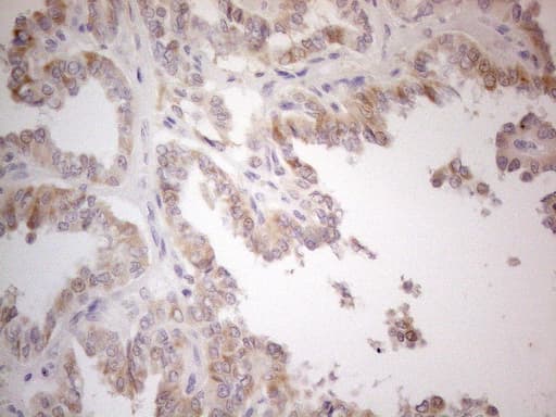 PDIA6 / ERP5 Antibody (clone OTI2H3)