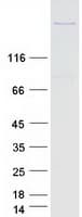 Human FER1L6 Protein (Recombinant Myc-DDK (Flag))