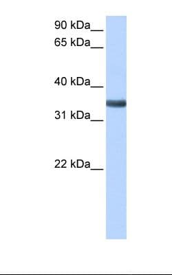 SPON2 / MINDIN Antibody (aa190-239, Biotin)