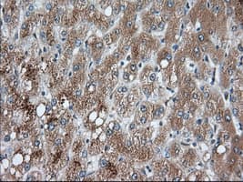 Monoclonal Mouse anti-Human PANK2 Antibody (clone OTI3H9, IHC, IF, WB)