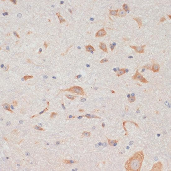 AXIN2 / Axin 2 Antibody